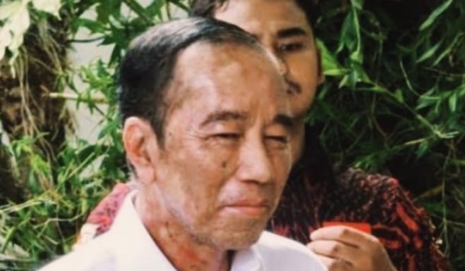 386645_05383029062025_Presiden_Jokowi_sakit_2